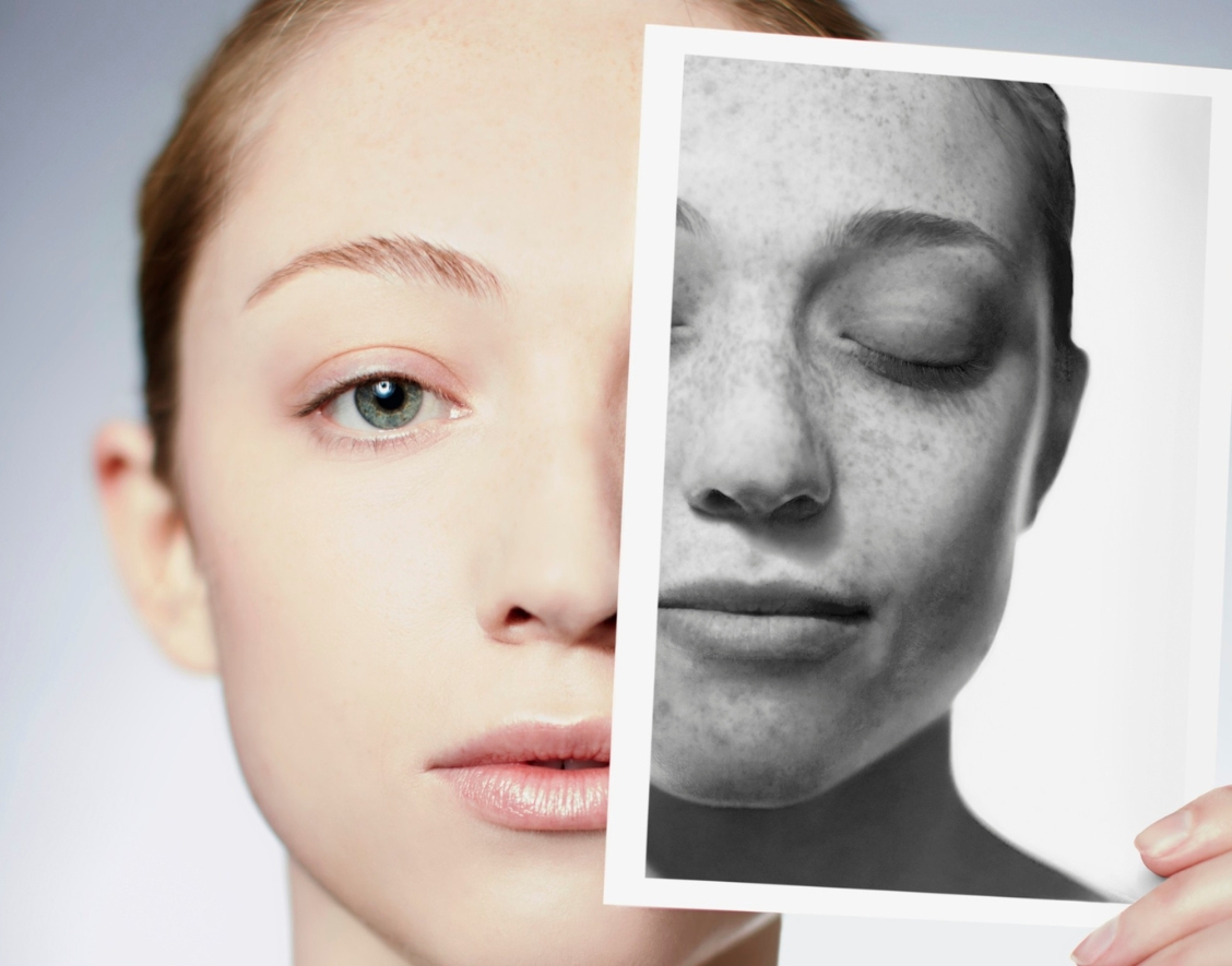 Spot the Difference: Clearer, Brighter Skin Starts Here.